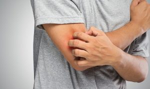 Mantar Hastalığı Hakkında Bilinmesi Gereken 6 Önemli Bilgi!